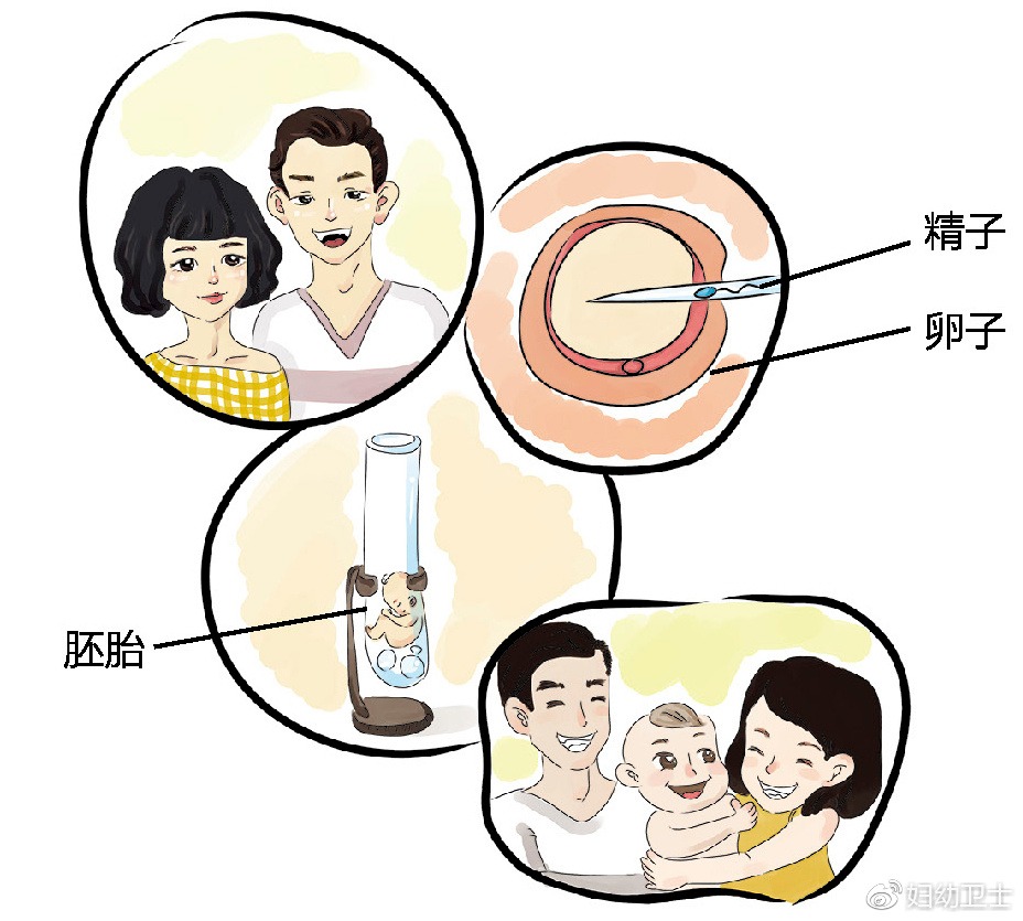 備孕孕檢