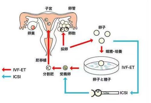 懷孕初期出血