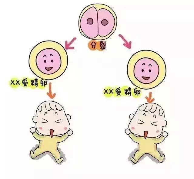 坐月子