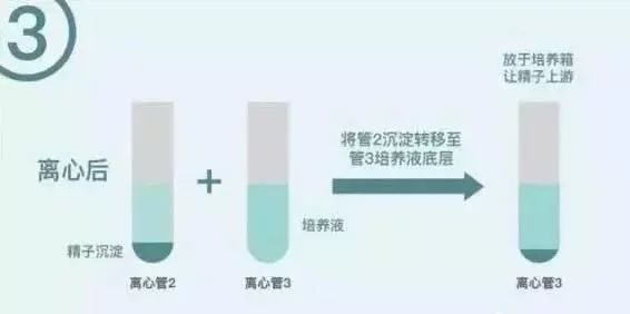 備孕免費(fèi)檢查