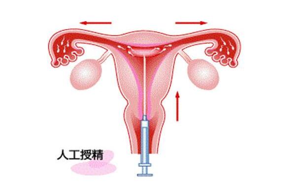 乳腺堵塞