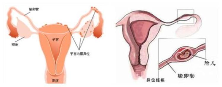 備孕期間吃什么水果受孕率高