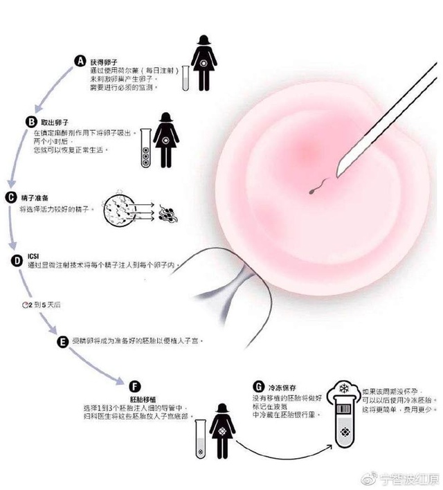 備孕