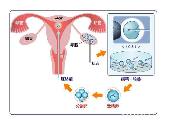 墮胎