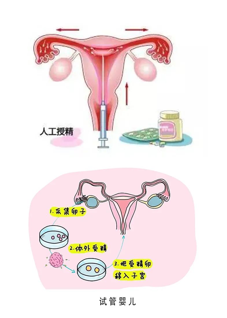備孕