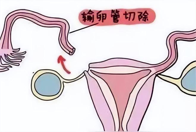 備孕檢查