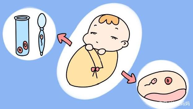 嘉興試管嬰兒攻略