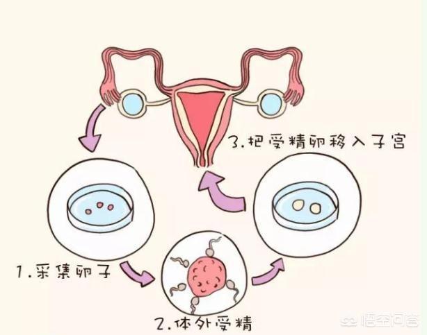 嘉興試管助孕