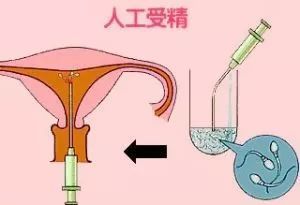 捐卵