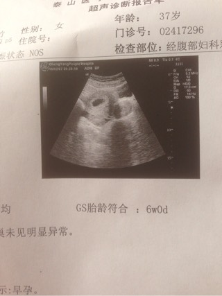 排卵